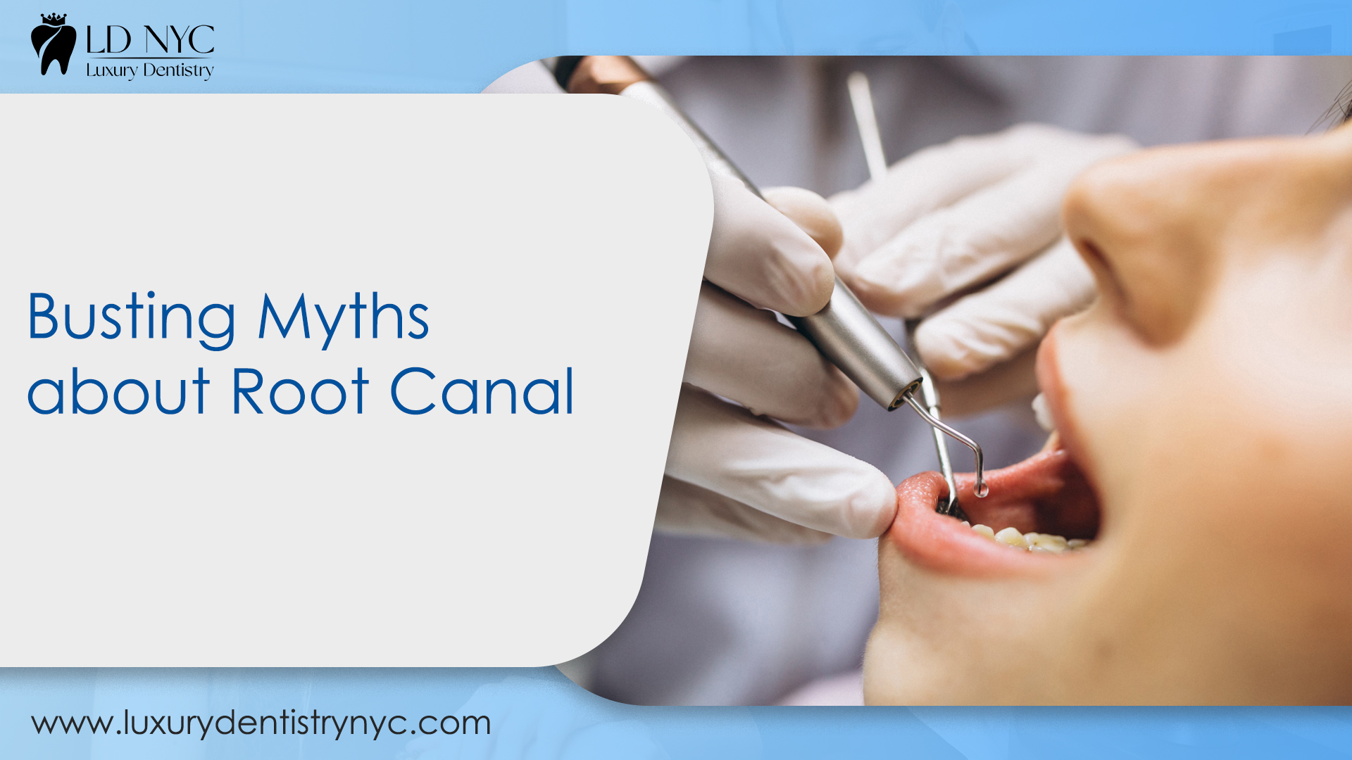 Debunking Root Canal Myths Debunking Root Canal Myths