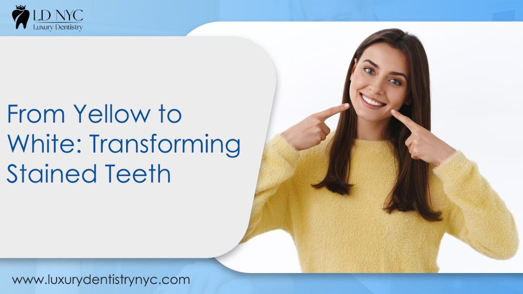 From Yellow to White: Transforming Stained Teeth