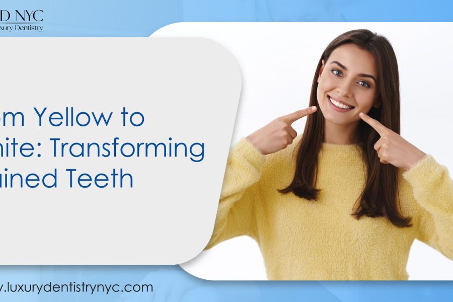 From Yellow to White: Transforming Stained Teeth