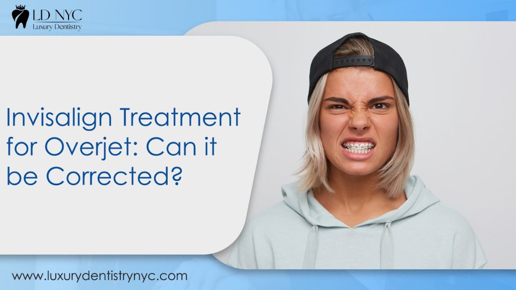 Invisalign Treatment for Overjet: Can it be Corrected?