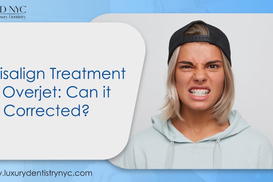 Invisalign Treatment for Overjet: Can it be Corrected?