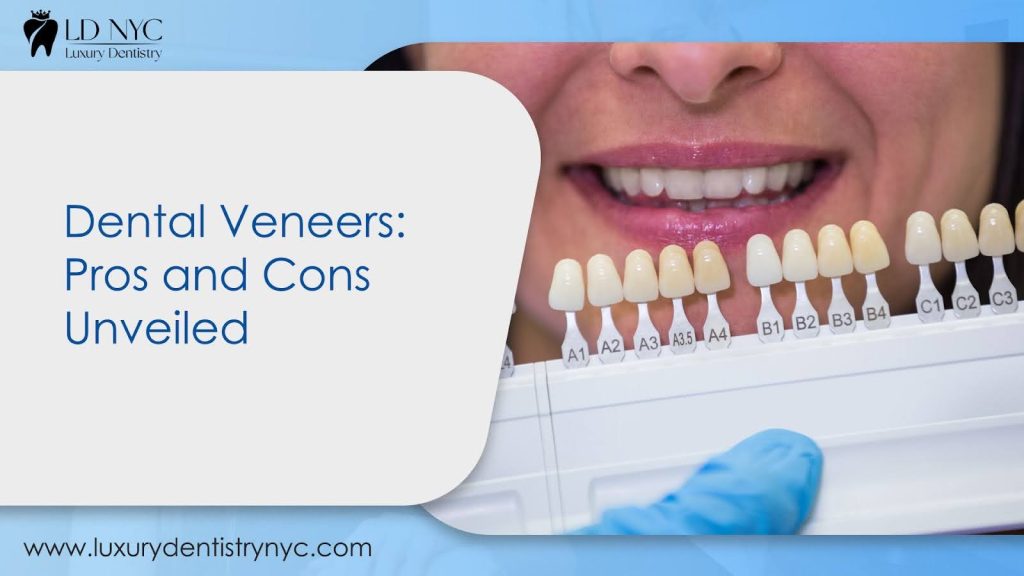 Dental Veneers: Pros and Cons Unveiled