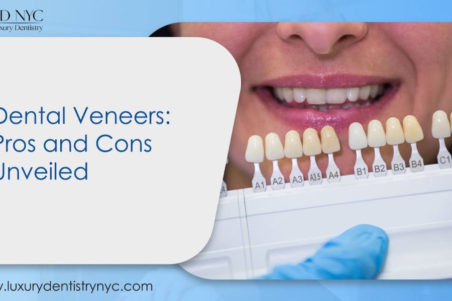 Dental Veneers: Pros and Cons Unveiled