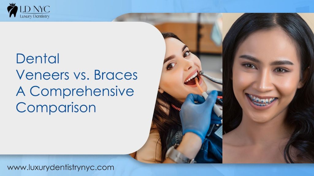 Dental veneers vs. braces: Which is better?