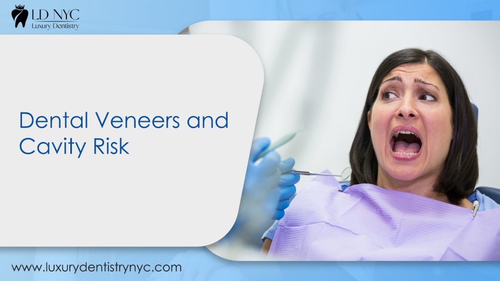 Dental Veneers and Cavity Risk