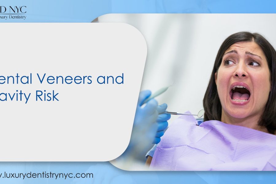 Dental Veneers and Cavity Risk
