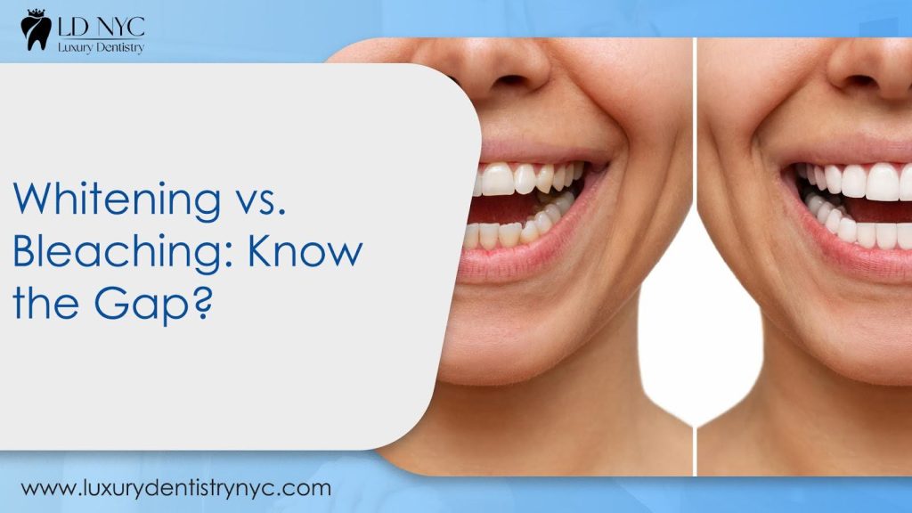 Whitening vs. Bleaching: Know the Gap?