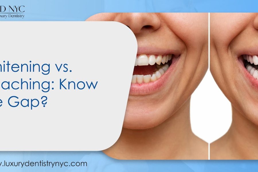 Whitening vs. Bleaching: Know the Gap?