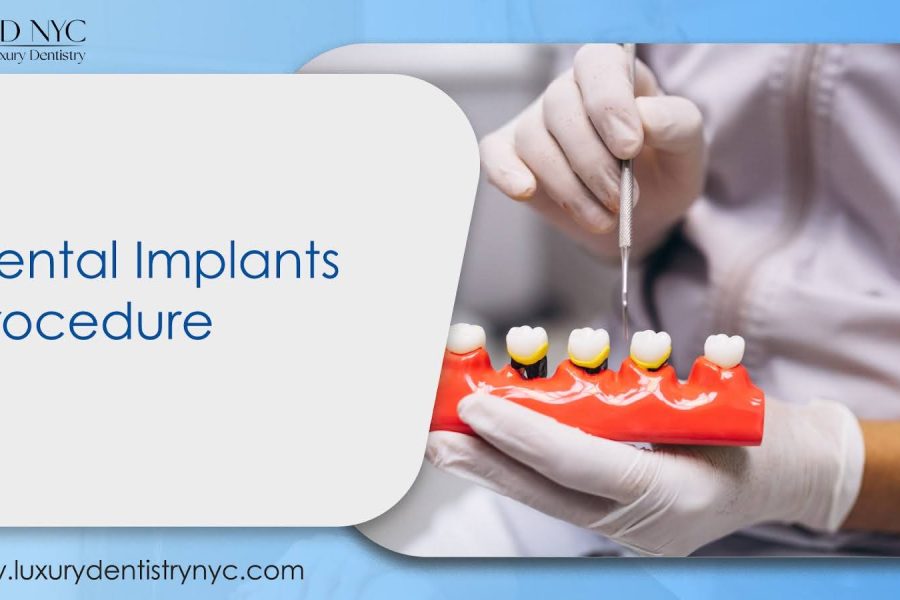 Dental Implants Procedure