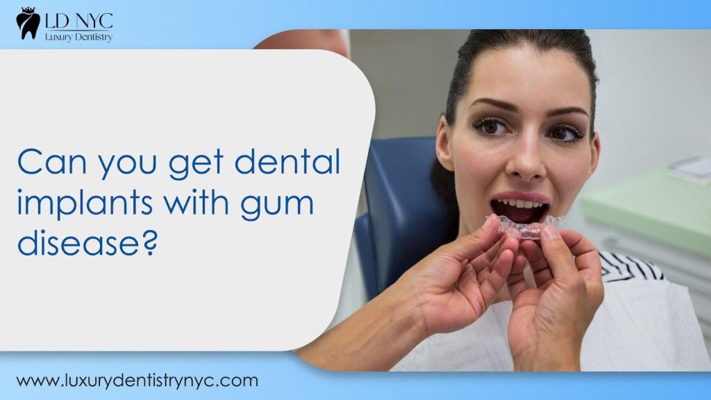 Can you get dental implants with gum disease